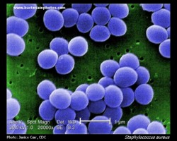 staphylococcus micrograph, golden staph scanning electron micrograph